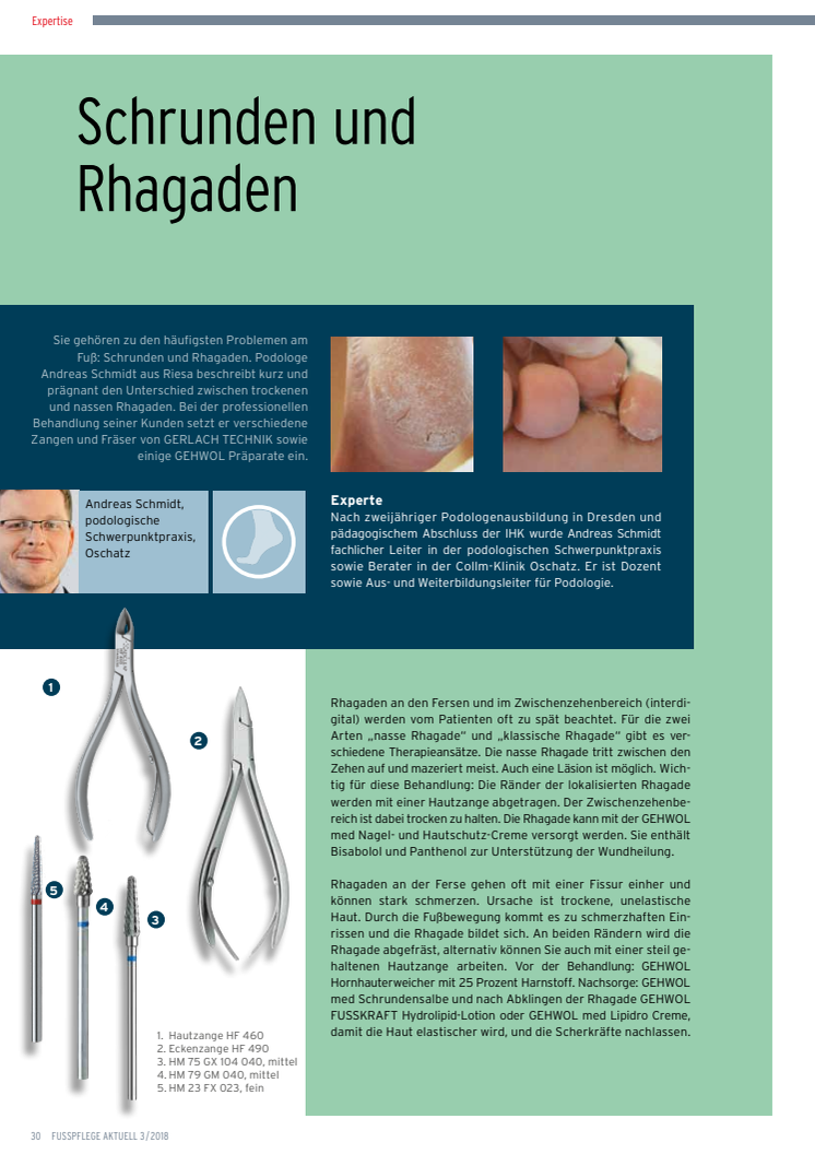 Schrunden und Rhagaden