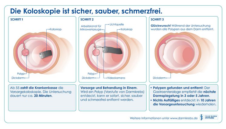 Wie funktioniert die Darmkrebsvorsorge mittels Koloskopie?