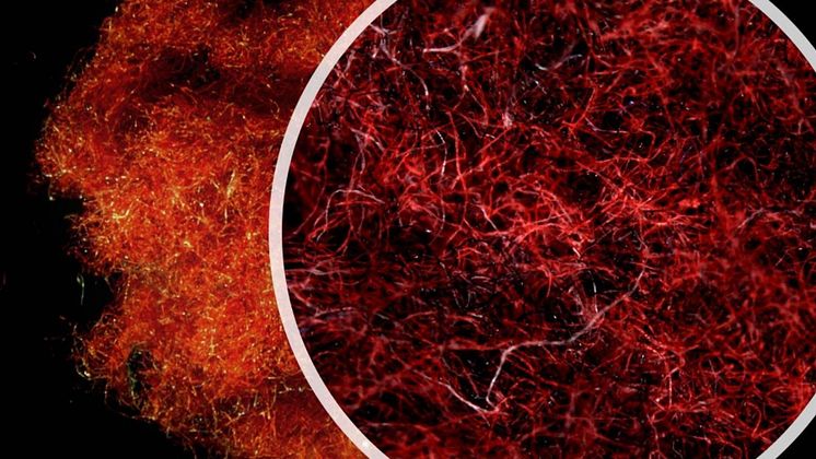 striking image from microscope of cotton and polyester fibres collected from tumble dryer exhaust