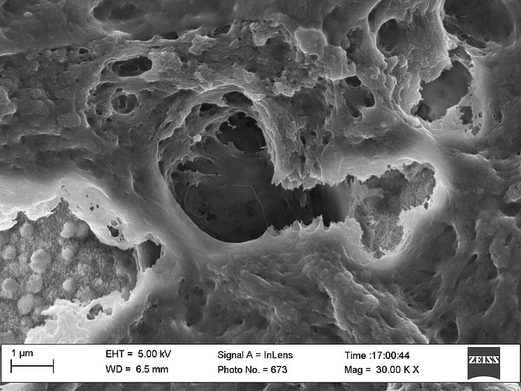Imaging bone surfaces with electron microscopy.