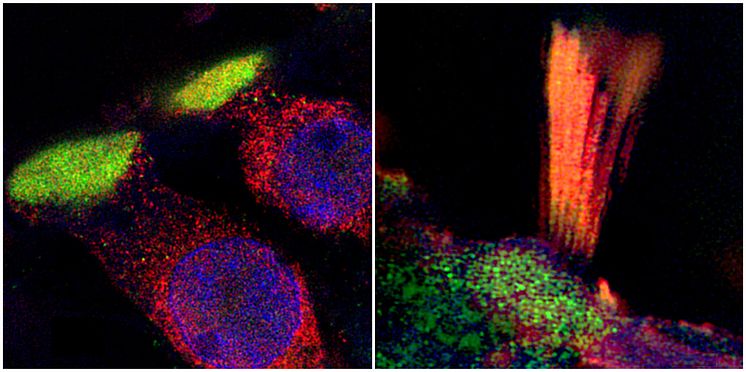 Proteins associated with hearing loss