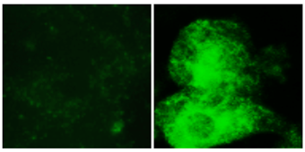 Flourescensmikroskopbild på brunfettsceller