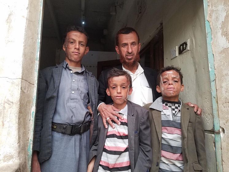 Omar*, 12 år i Jemen
