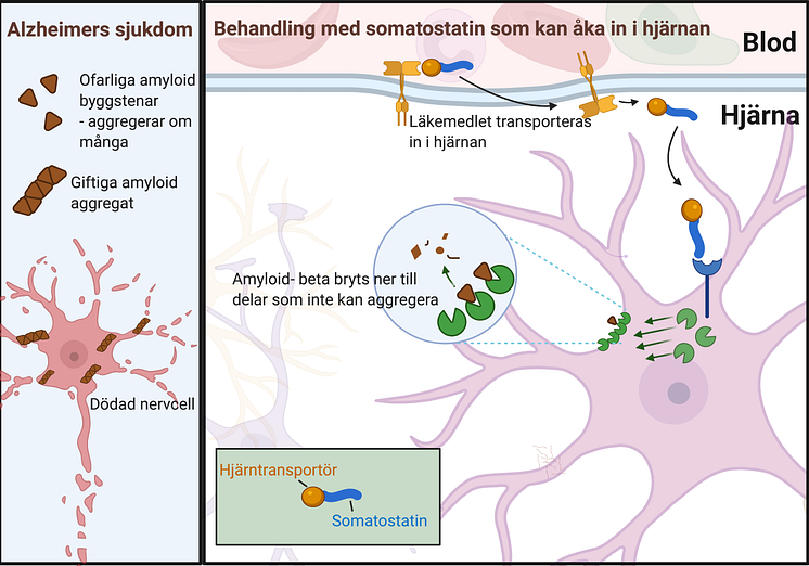 Alzheimers sjukdom