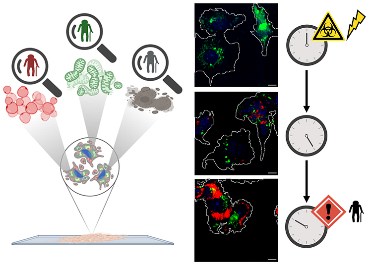 Innovative optical technologies for non-invasive microscopy allowed the research team to reveal the overproduction of lipid droplets, the mitochondrial network rearrangement and the morphological resha