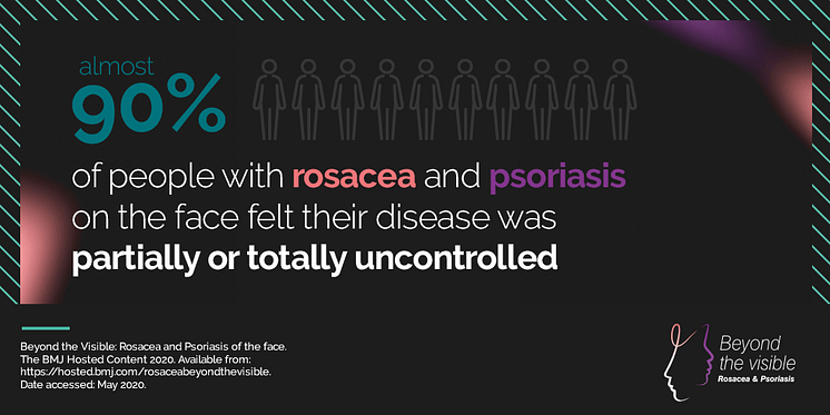 90% av personer med rosacea och psoriasis i ansiktet känner att deras hudåkomma var helt eller delvis okontrollerad