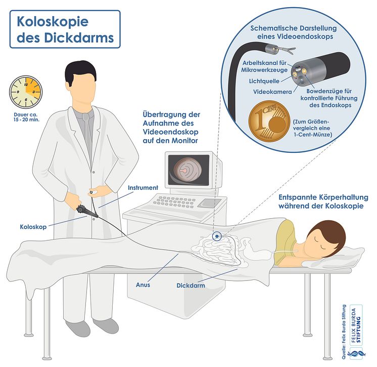 Darmspiegelung/Koloskopie des Dickdarms