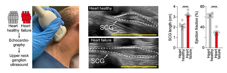 Abbildungen_Dr-Ziegeler_SCG_Ultrasound_Neu