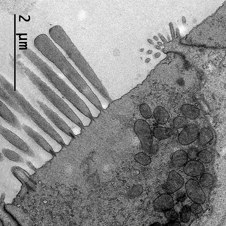 hair cell of a crocodile magnified around 5000 times