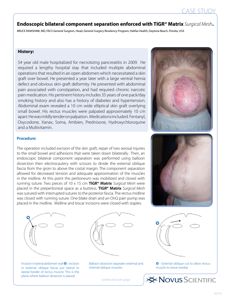 Case Study - From Dr Bruce Ramshaw, MD, FACS