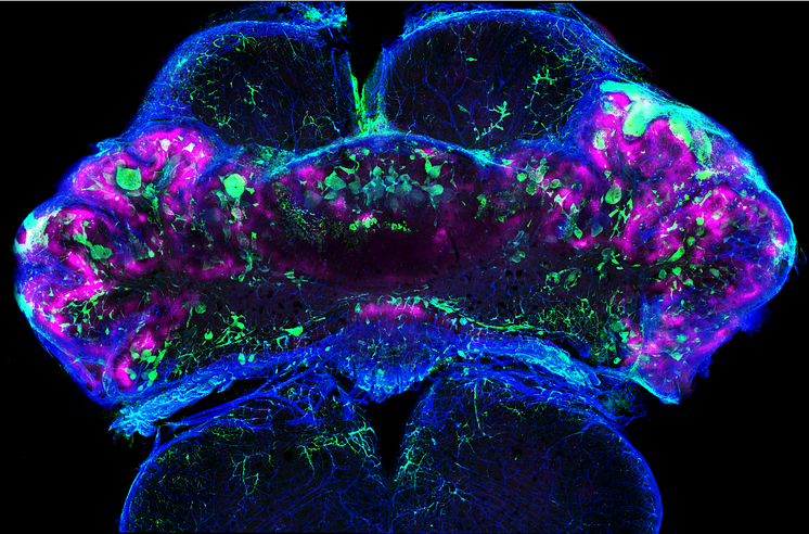 Mouse brain regions that lack oxygen