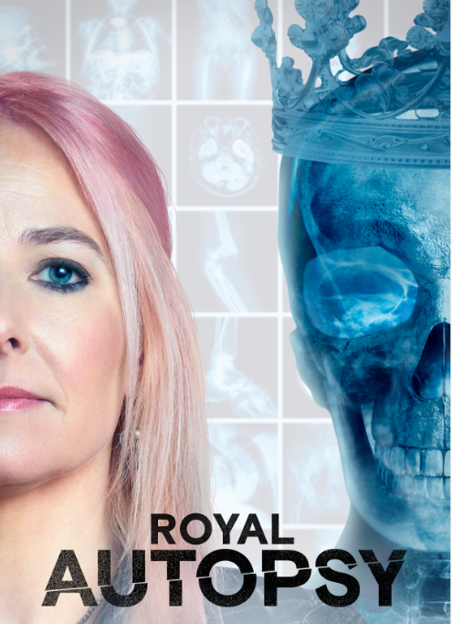 Royal Autopsy S2 The HISTORY Channel