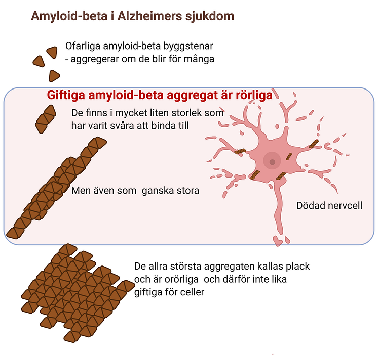 Alzheimers sjukdom