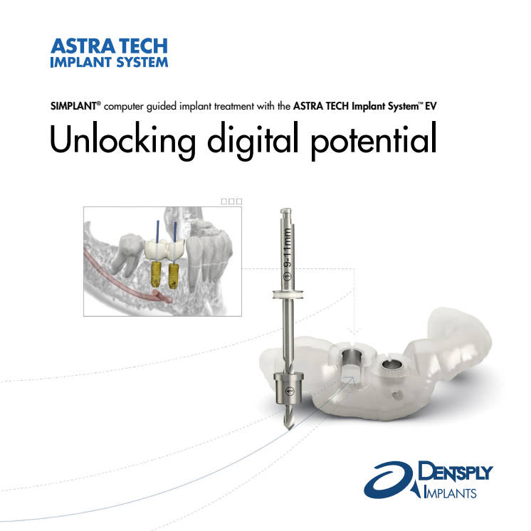 Unlocking digital potential - SIMPLANT with ASTRA TECH Implant System EV