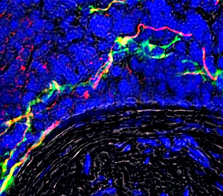 Aufnahme_Wachsendes-Nervennetzwerk-in-betroffener-Arterie_LMU-Klinikum