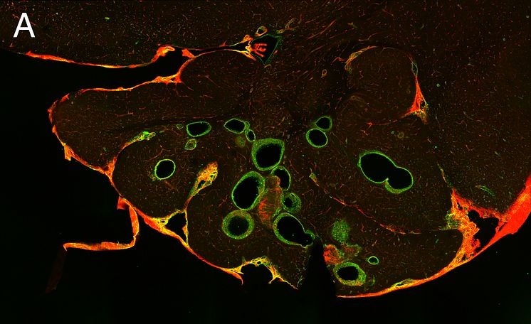 Brain section no propranolol