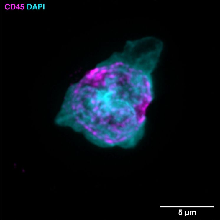 Immune cell isolated from mouse with CCM 
