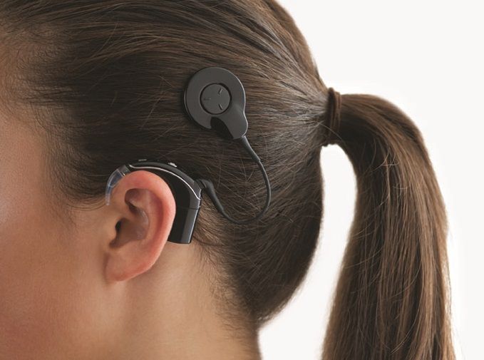 Cochlear™ Nucleus® 7 Soundprozessor