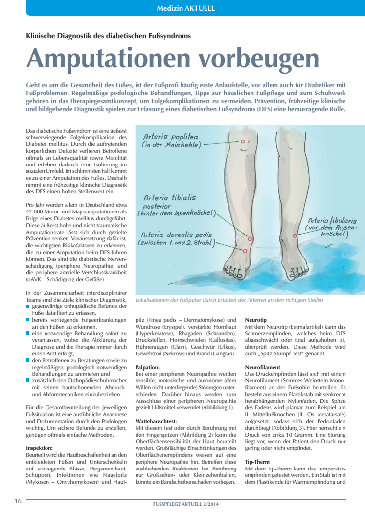 Amputationen vorbeugen: Klinische Diagnostik des diabetischen Fußsyndroms