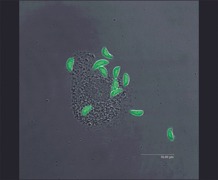 Toxoplasma gondii och en immuncell.