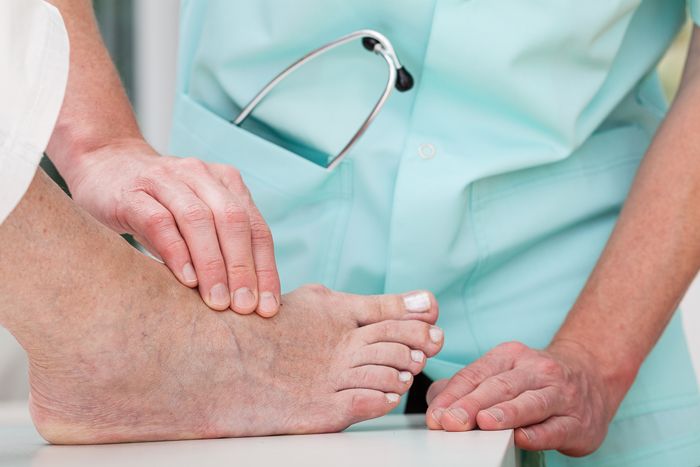 Identifikation von Risikopatienten für das Diabetische Fußsyndrom: bei jeder Untersuchung die Füße und Schuhe kontrollieren