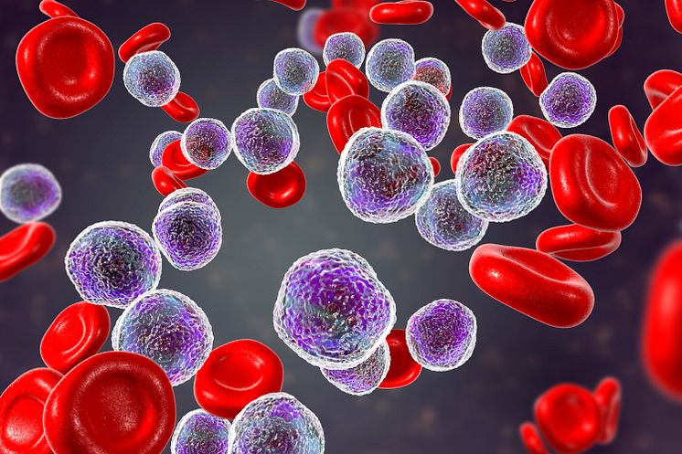 leukemi-iStock
