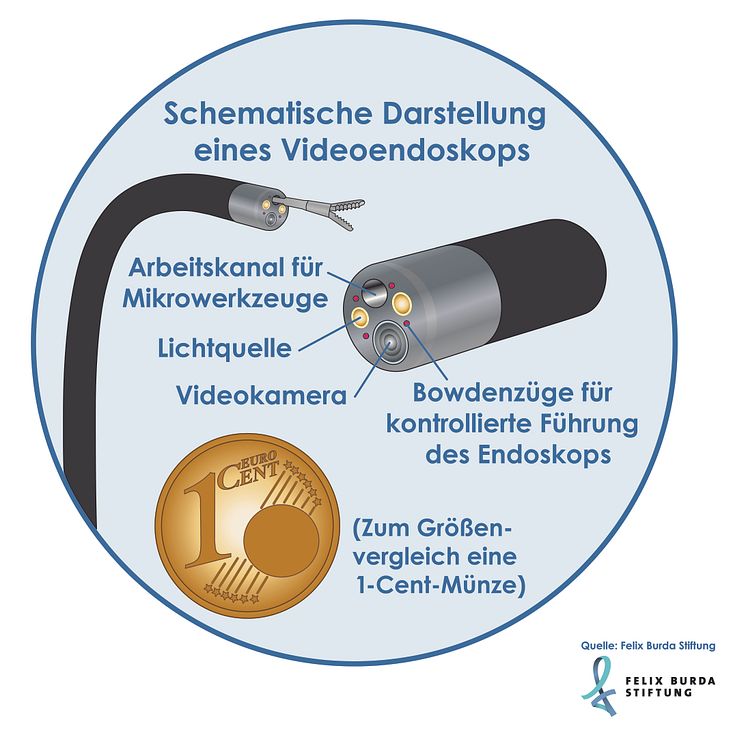 Schematische Darstellung eines Videoendoskops_2018