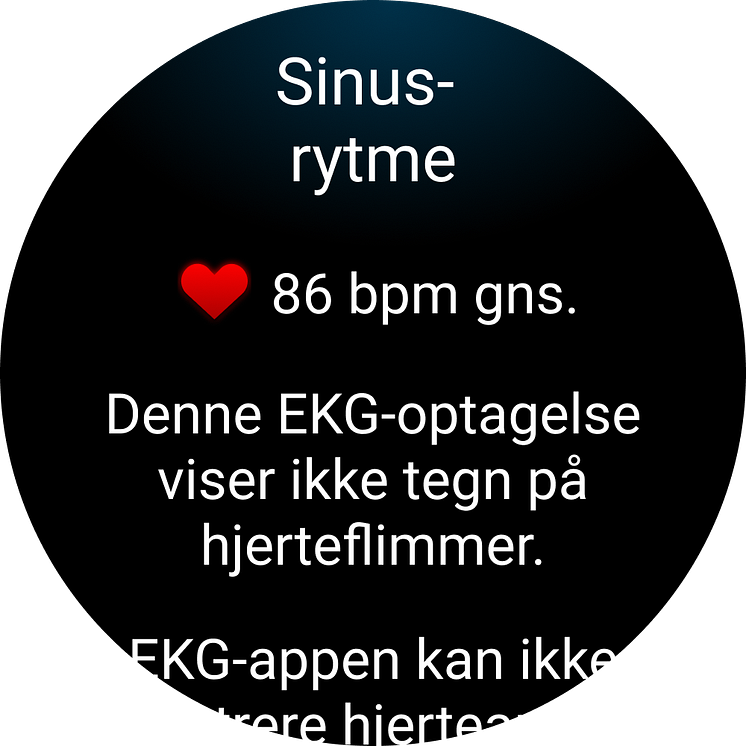 Garmin EKG app watch screen.png