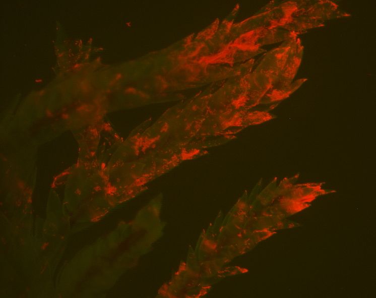 Cyanobakterien Stigonema på ytan av ett mossblad sett med fluorescensljus i mikroskop. 