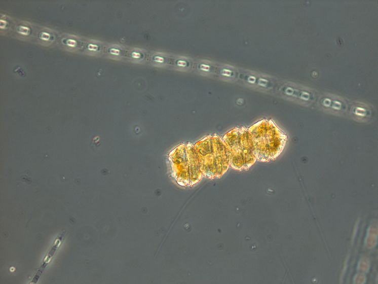 Koloni av dinoflagellaten Peridiniella catenata med 4 celler. Foto: Helena Höglander