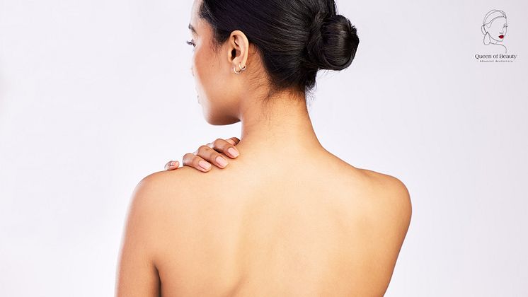 queen_of_beauty_trapezius_tox