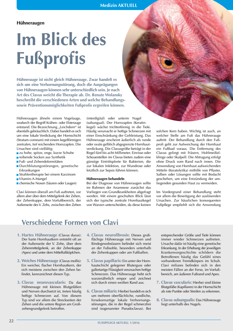 Hühneraugen: Im Blick des Fußprofis