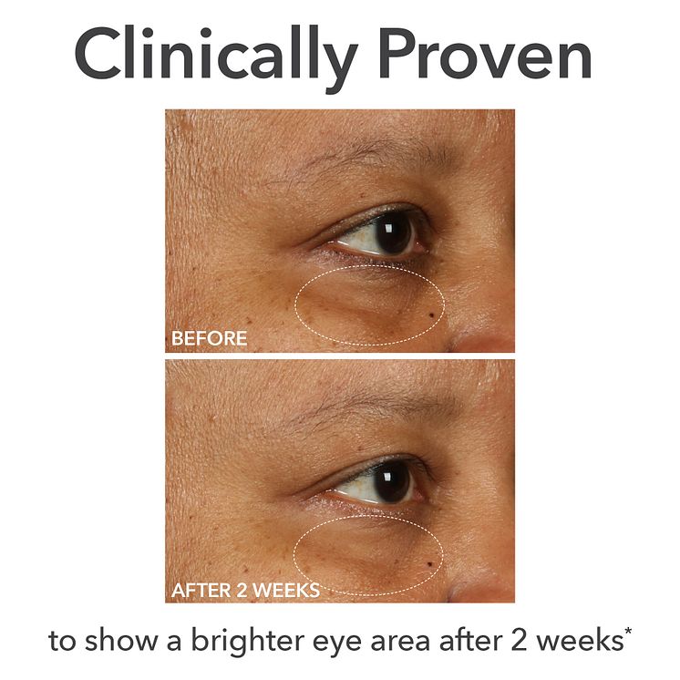 03_DI_Eye_B&A.jpg
