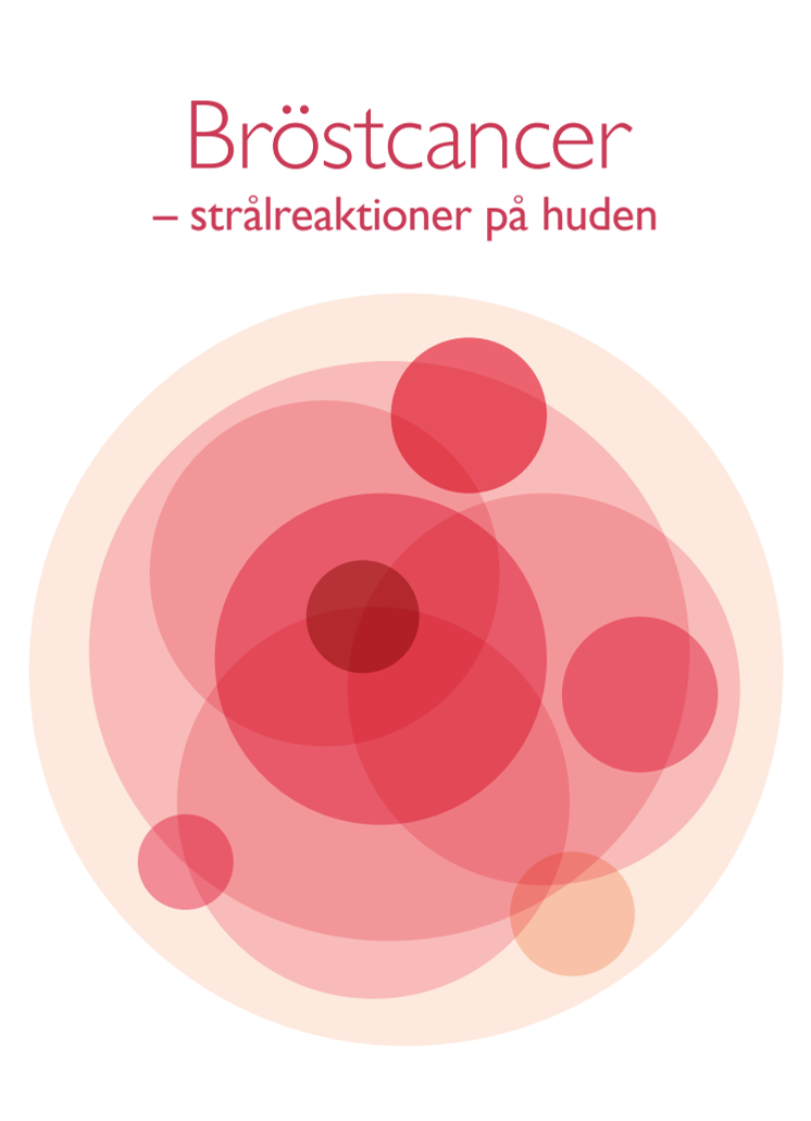 Bröstcancer – strålreaktioner på huden