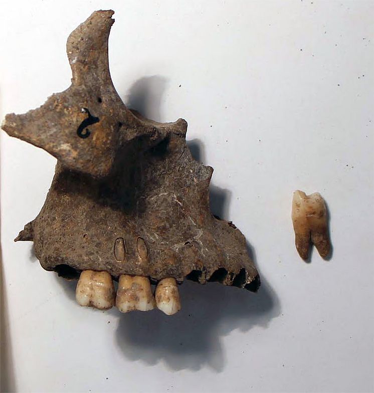 Maxilla and tooth / Överkäke och käke