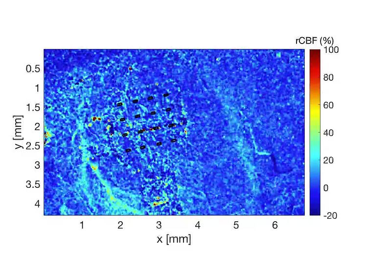 Cerebral blood flow after cortical spreading depression observed though graphene (Credit: ICFO/Ernesto Vidal).