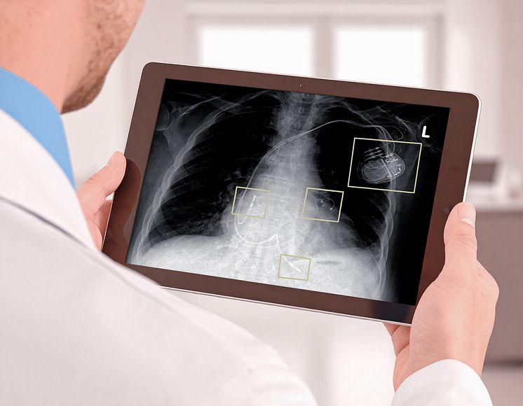PLATUNA® PT / Platinbeschichtung für Medizintechnik von Umicore Galvanotechnik