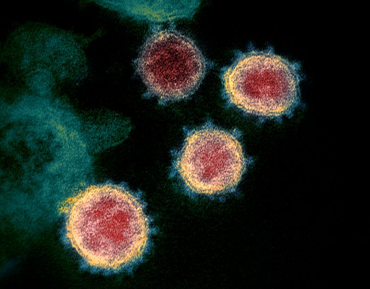 Coronavirus_wikimedia commons.jpg.jpeg