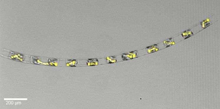 Mikroskopbild av cellkedja där varje cell innehåller kluster av lysande gula strukurer. 