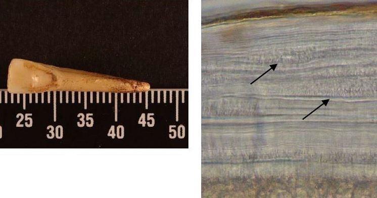 Archaeological sample of a tooth and a magnified image showing variations in the tooth's cementum rings from smoking
