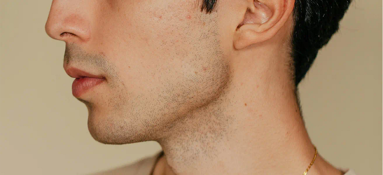 double-chin.webp