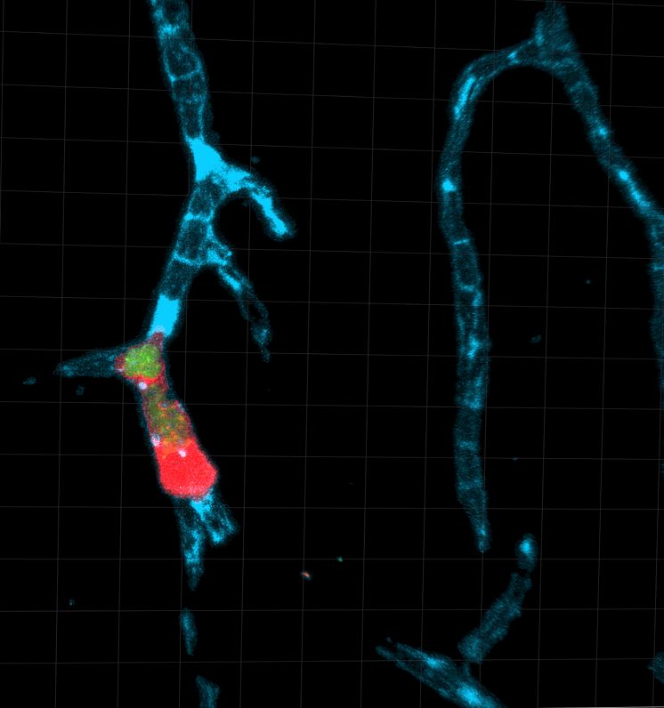 Toxoplasma gondii.jpg
