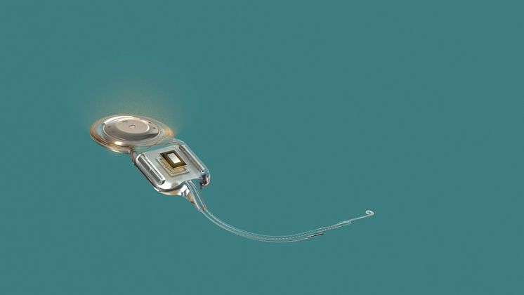 Nexa_memory_on_the_implant.jpg