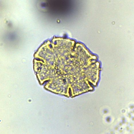 A pollen grain of the southern beech Nothofagus; the dominant tree during the Early Oligocene